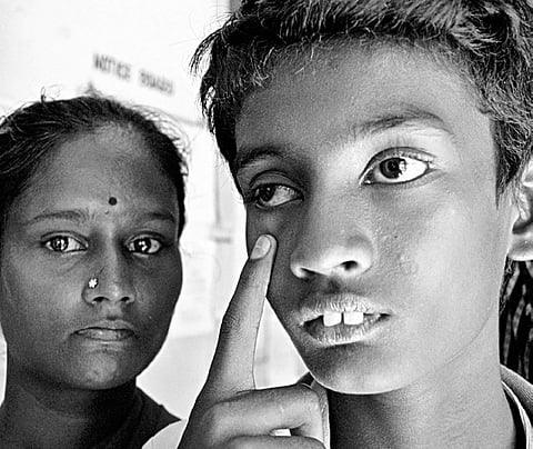 14-year-old loses sight in alleged police torture