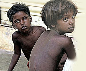 India's shame: Tops list of malnourished kids