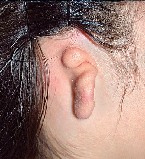 Growing Ears and noses in a lab