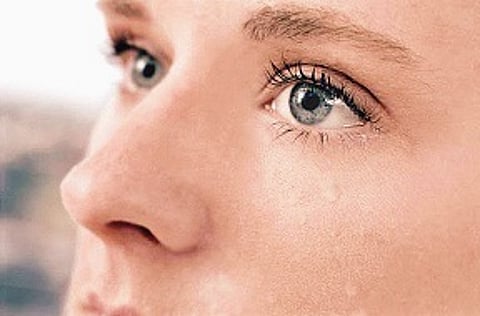 Inflamed Eyes Need Attention