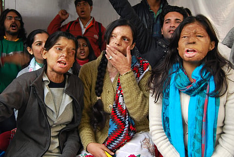 A Chennai-based hospital, in association with an NGO, will conduct a ‘surgery drive’, free of cost for acid attack survivors. (File | EPS)