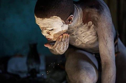The ritual is revered and guarded by the Xhosa people, but the unhygenic conditions -- and abuse by some initiation schools -- exacts a heavy toll. (AFP)
