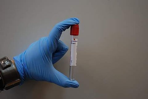 Image used for representational purpose