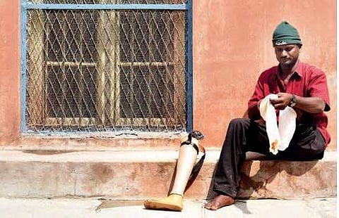 Hyderabad: Prisons department equips disabled man with artificial limb