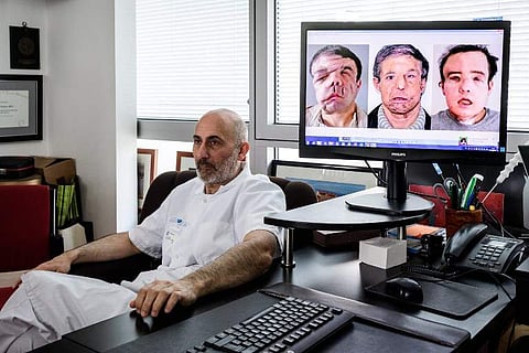 French medicine professor Laurent Lantieri, a specialist in hand and face transplant, poses next to a screen showing different steps of his patient Jerome Hamon's surgery at the Hopital Europeen Georges-Pompidou in Paris. (AFP)