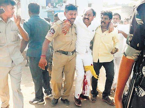 Mantralayam TDP candidate P Tikka Reddy after police misfire | Express