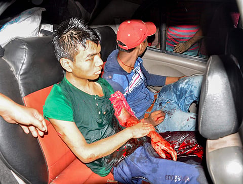 An injured is rushed to hospital for treatment after suspected grenade blast in Assam (Photo | PTI)