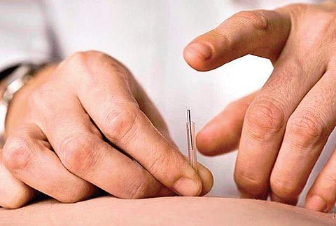 Chronic Fatigue Can be Cured with Acupuncture
