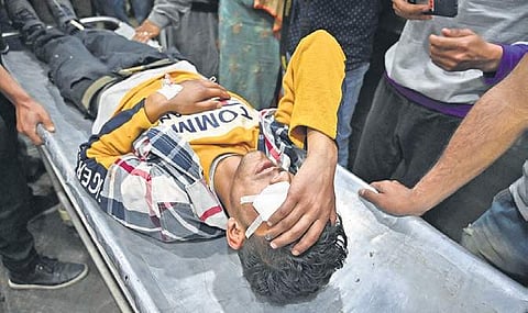 An injured youth being transported after he was wounded by pellets in Srinagar. | (File | AFP)