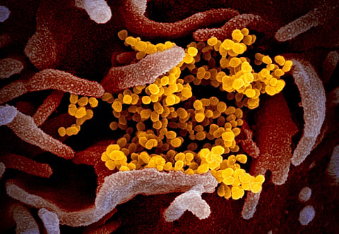 Microscopic images of novel coronavirus. (Photo | NIAID - RML)