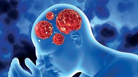 Novel approach for early detection of Parkinson’s disease