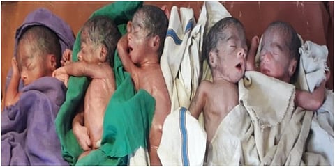 Woman gives birth to five babies in UP's Barabanki