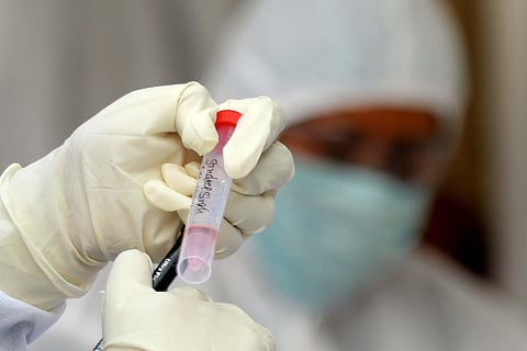 Health care workers take collecting samples at a COVID-19 coronavirus testing camp for journalists during the Coronavirus outbreak. (Photo | Shekhar Yadav/EPS)