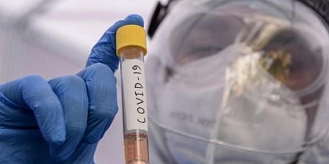 For representational purposes (Photo | PTI)