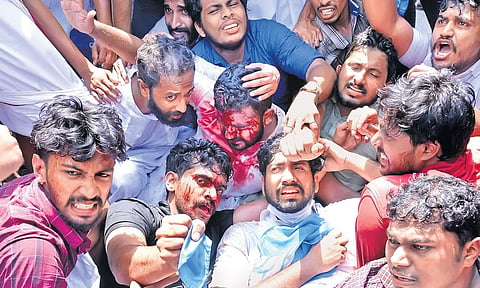KSU state president K M Abhijith, NSUI national coordinator Nabeel Kallambalam and others, who were injured in the clash with the police in front of the Secretariat, raise slogans on Thursday | Vincen