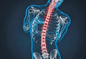 Right cure for the curved spine