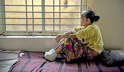 Image of a leprosy patient used for representational purpose only.