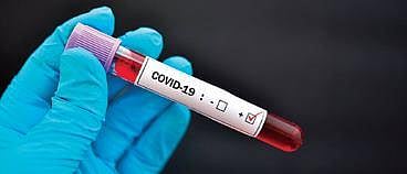 Each Covid patient infected 12 others, shows serosurvey in Karnataka