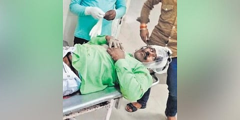 Cardboard used to dress fractured leg at govt health centre in MP