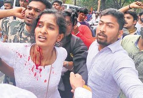 A student activist injured in caning by police at Jnana Bharathi campus