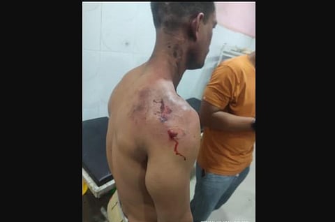 A person who got injured during the clash with police (Photo | EPS)