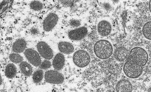 Mexico confirms first monkeypox case(Photo | AFP)