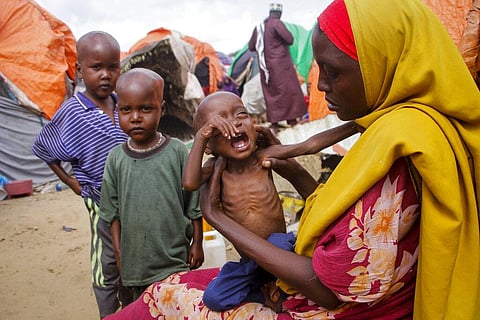 Maryan Madey, who fled the drought-stricken Lower Shabelle region, holds her malnourished daughter Deka Ali, 1, at a camp for the displaced on the outskirts of Mogadishu, Somalia(Photo | AP)