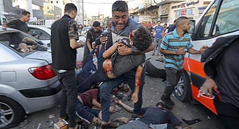 A man steps over the bodies of dead and injured Palestinians lying on the ground following an Israeli airstrike outside the entrance of the al-Shifa hospital in Gaza City.
