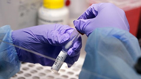 Image used for representational purpose only. (File photo | AP)
