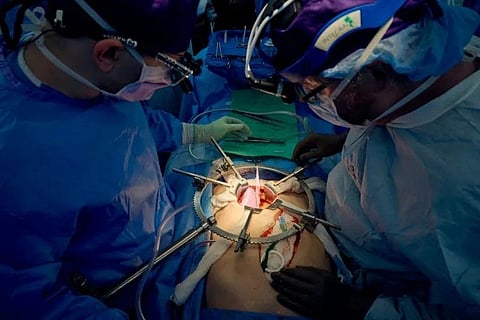 A team of surgeons transplanting a pig kidney into a brain dead patient, part of a growing field of research aimed at advancing cross-species transplants and closing the organ donor gap. (Photo | AFP)