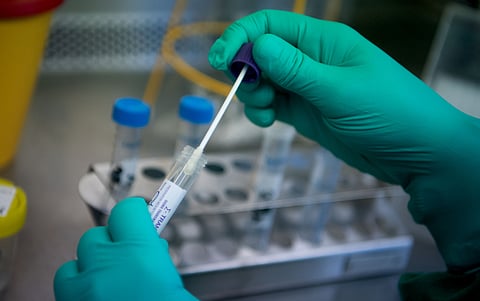 coronavirus testing kit