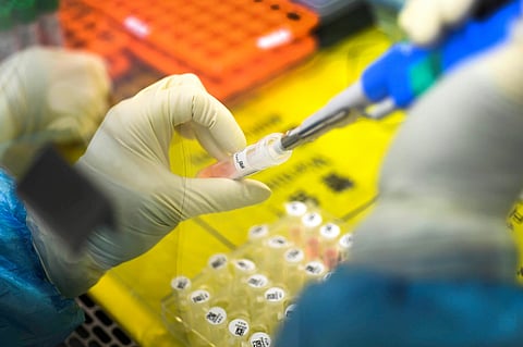 Coronavirus testing kit