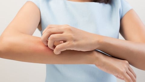 त्वचेवरील खाज आणि पुरळपासून सुटका मिळवण्यासाठी वापरा 'या' टिप्स