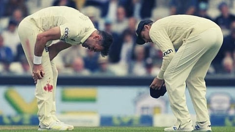 Eng vs Ind: Despite injury James Anderson shows sporting spirit