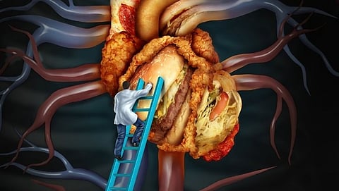 High cholesterol