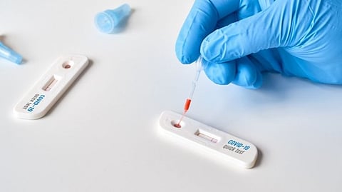 Is it possible to test Omicron at home? Find out the opinions of experts