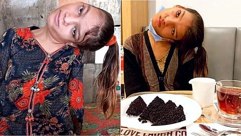 neck of the Pakistani girl was turned at a 90 degree angle