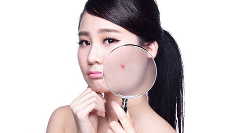 skin problem