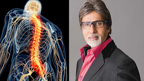Big B was suffering from spinal TB