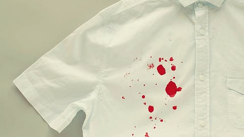 Stain on White Uniform Remedies