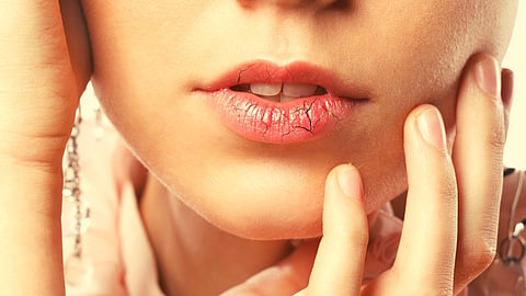 Dry Lips Remedies at Home