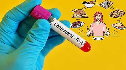 Bad Cholesterol Food