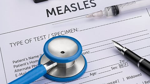 Measles Causes