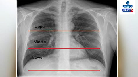 X Ray
