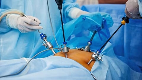 Operation