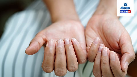 Dry Nails