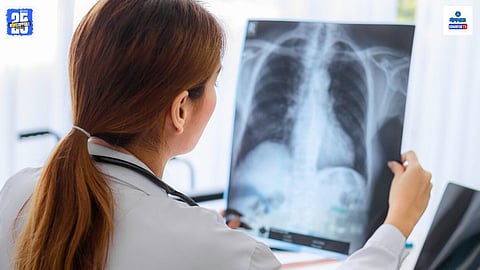 Lung Cancer