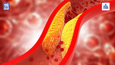 Quitting Alcohol And Cholesterol
