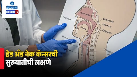 Head And Neck Cancer