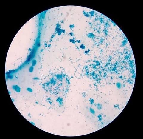 Nanocomposites were studied and found effective against multi-drug resistant variants of bacteria